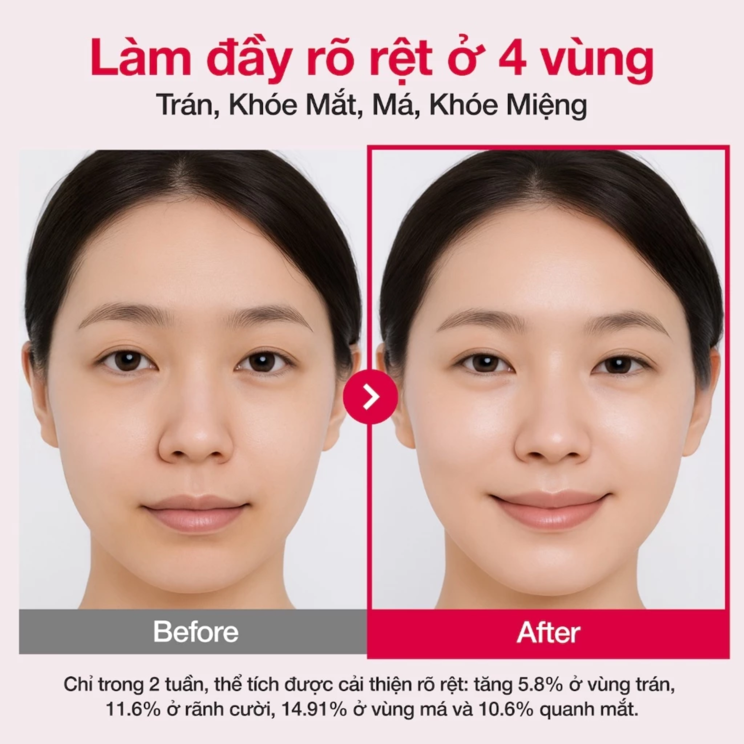 Tinh chất Numbuzin No.2 Rose PDRN Collagen 2X Plumping Serum 30ml - Ảnh 6