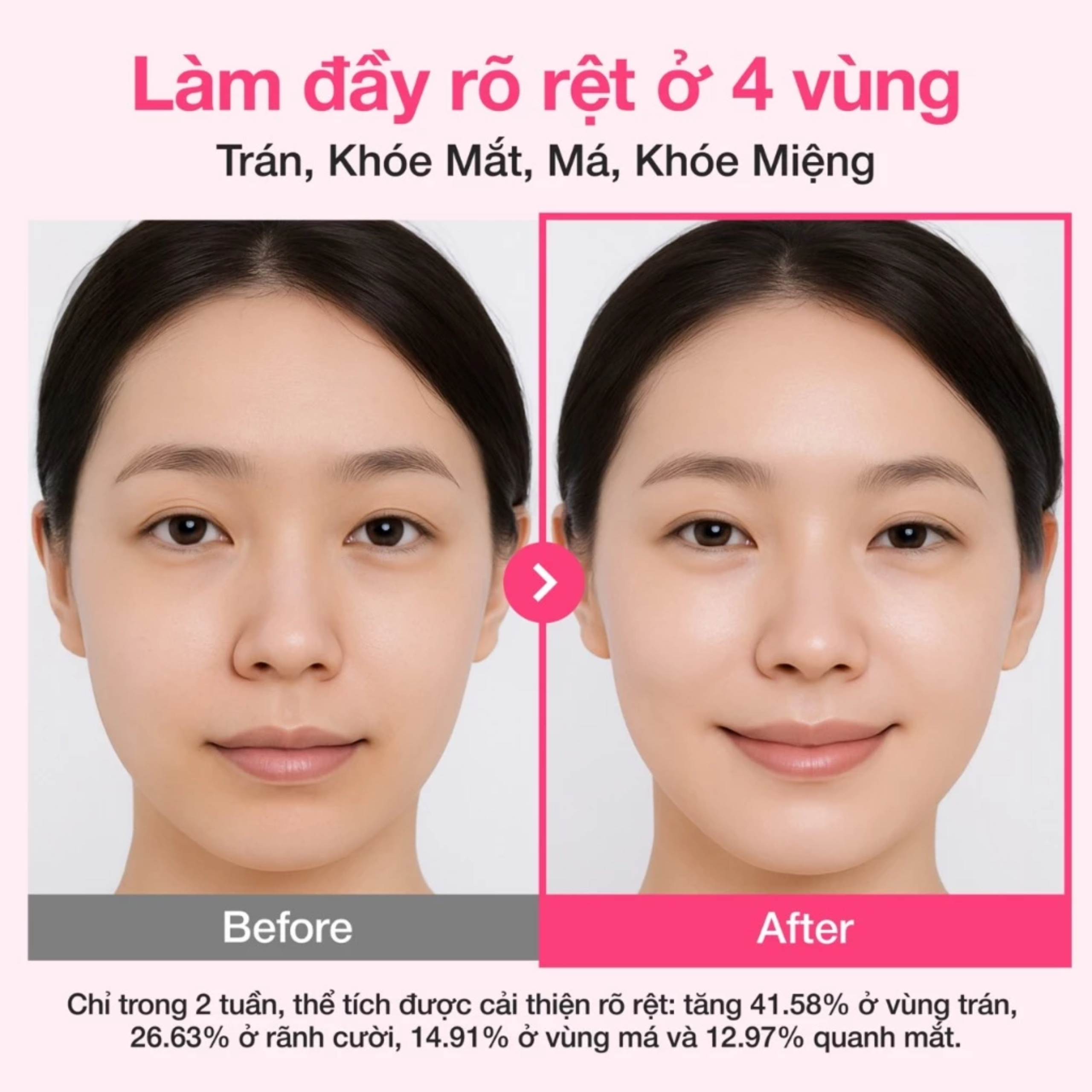 Tinh chất Numbuzin No.2 Rose PDRN Collagen Plumping Serum 30ml - Ảnh 5