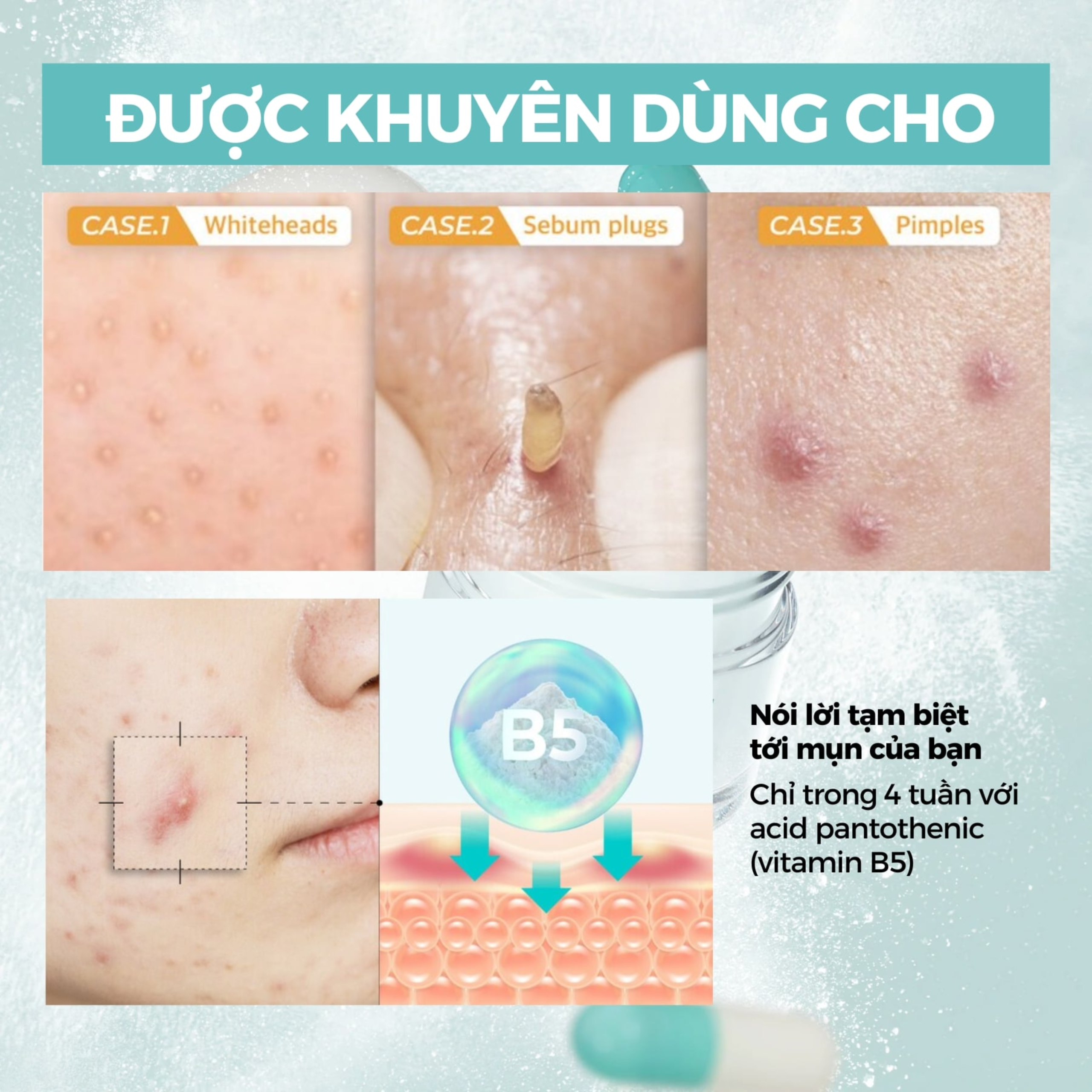 Kem Dưỡng Numbuzin No.1 Pantothenic B5 Active Smoothing 80ml - Ảnh 5