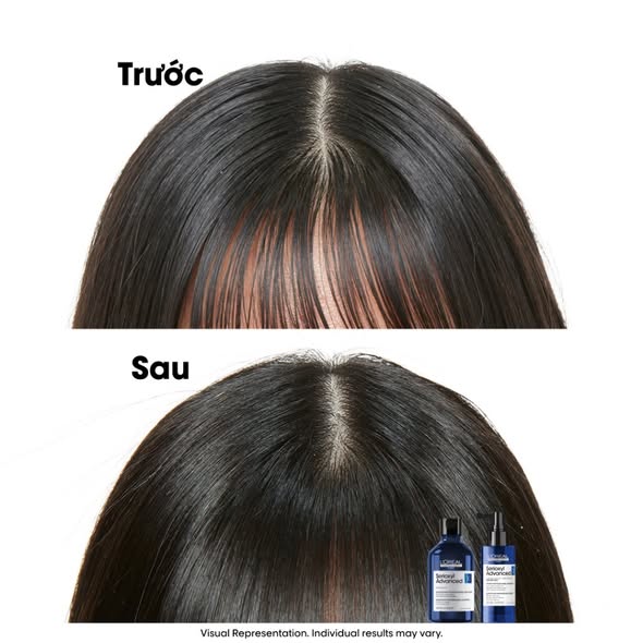 Tinh dầu dưỡng tóc Loreal Paris Professionnel Serioxyl Advanced 90ml - Ảnh 5