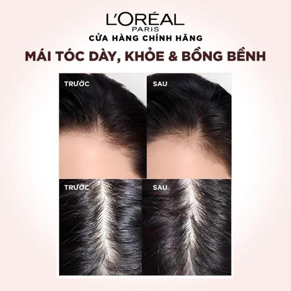 Dầu gội Loreal Full Resist Purifying Shampoo 440ml - Ảnh 3