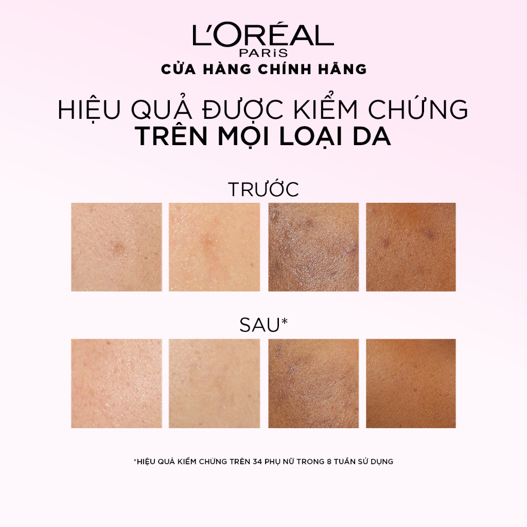 Tinh chất Tẩy tế bào chết Loreal Paris Glycolic Bright Exfoliant Peel 25ml - Ảnh 6